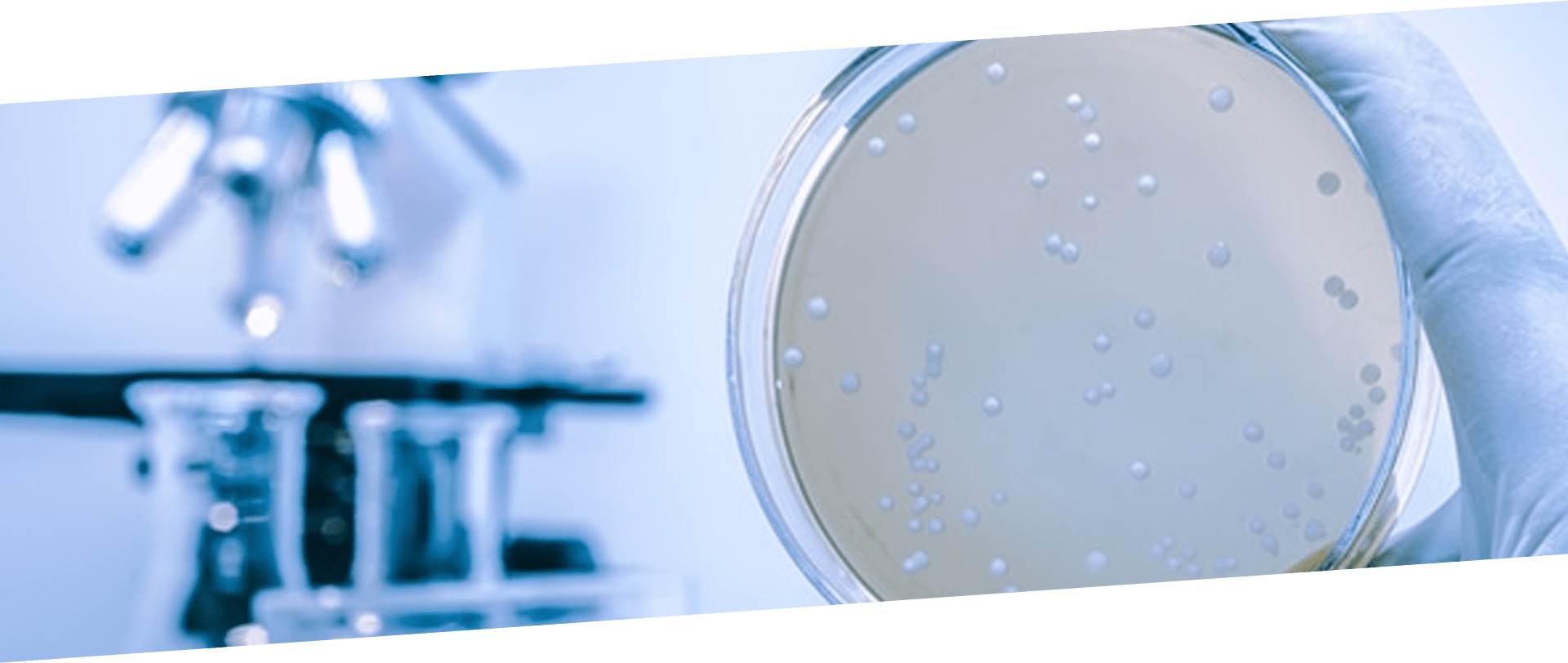 Monitoreo y análisis de agua: Es fundamental realizar análisis microbiológicos periódicos para evaluar la presencia de Legionella pneumophila y tomar las medidas necesarias en caso de detección